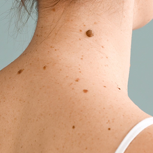 Moles